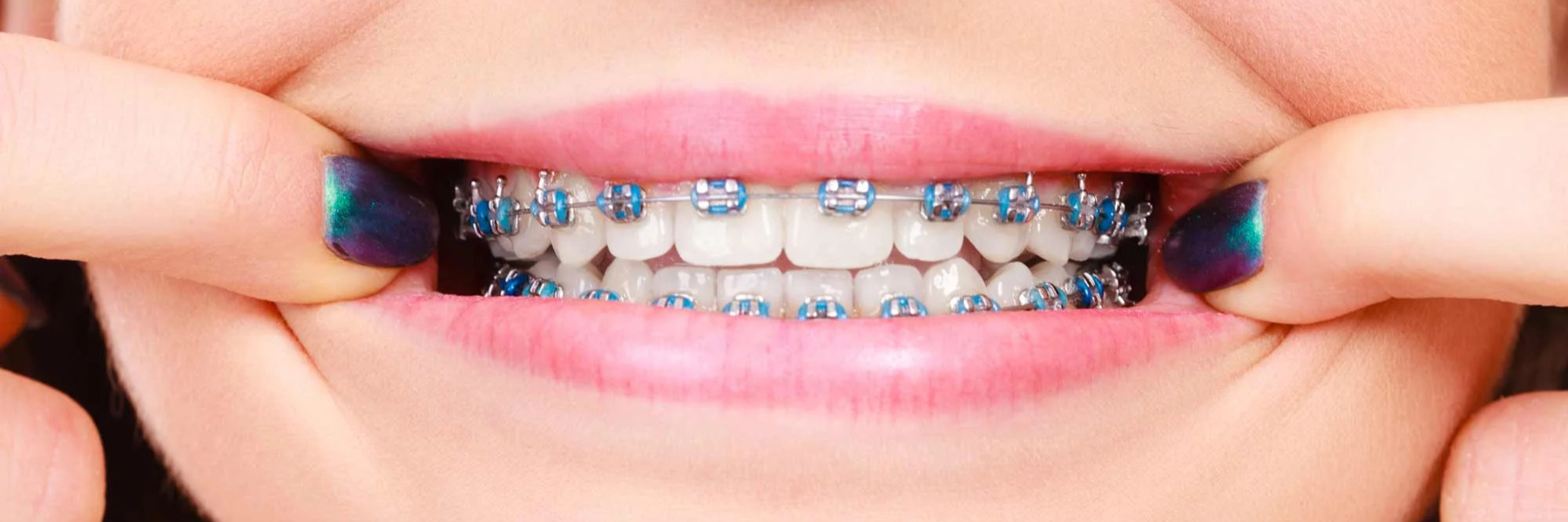 Orthodontics | Dentist