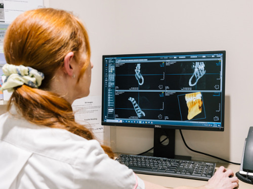 CBCT Cone Beam Technology